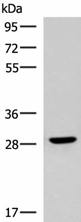 CLEC9A Polyclonal Antibody – Figure 1 of 2