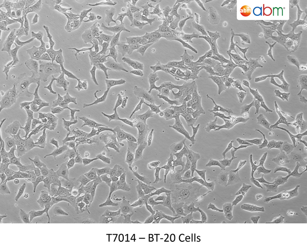 BT-20 Cells | Applied Biological Materials (abm)