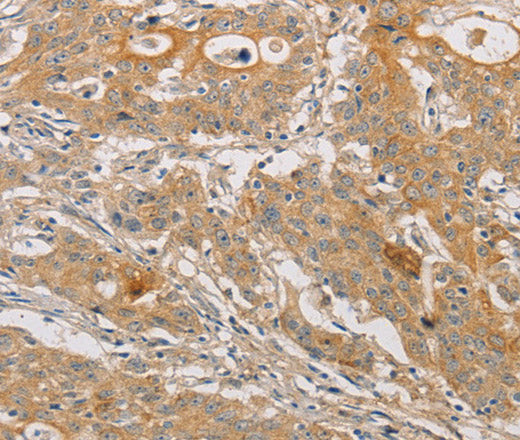 ARSK Polyclonal Antibody – Figure 1 of 3