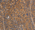 NOD1 Polyclonal Antibody – Figure 1 of 3