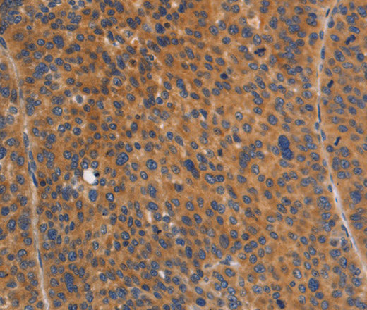 NOD1 Polyclonal Antibody – Figure 1 of 3