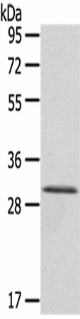HTATIP2 Polyclonal Antibody – Figure 1 of 2