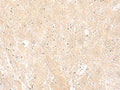 EMC1 Polyclonal Antibody – Figure 1 of 3