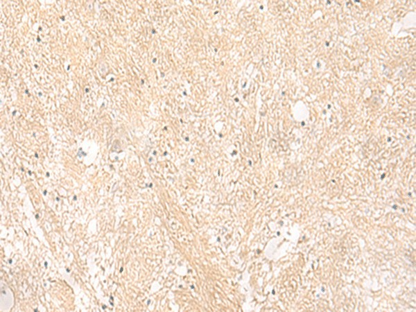 EMC1 Polyclonal Antibody – Figure 1 of 3