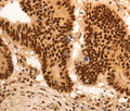 E2F7 Polyclonal Antibody – Figure 1 of 3