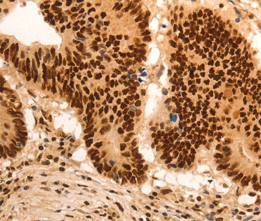 E2F7 Polyclonal Antibody – Figure 1 of 3