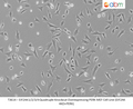 EIF2AK1/2/3/4 Quadruple Knockout Overexpressing PERK MEF Cell Line (EIF2AK 4KO+PERK) | Applied Biological Materials (abm)