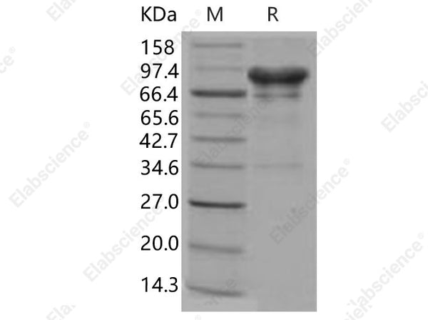 Recombinant Human Carbonic Anhydrase 9/CA9 Protein (Fc Tag) - Figure 1 of 2