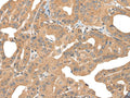 PPP3R1 Polyclonal Antibody – Figure 1 of 3