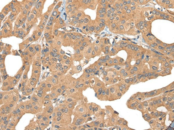 PPP3R1 Polyclonal Antibody – Figure 1 of 3