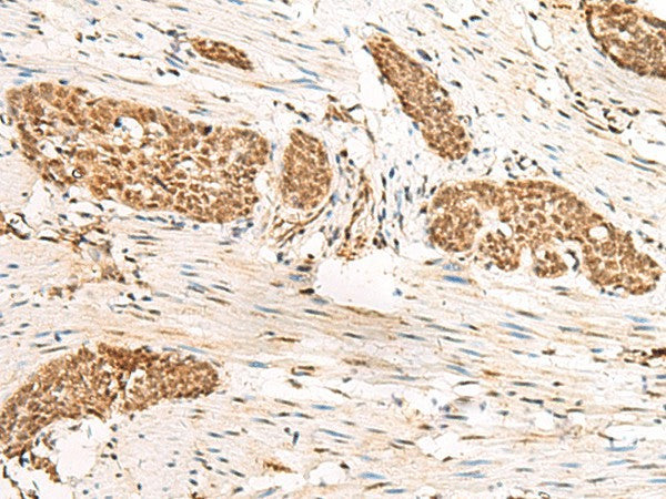 HUS1 Polyclonal Antibody – Figure 1 of 3