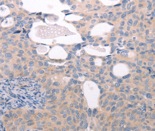 ABCF1 Polyclonal Antibody – Figure 1 of 3