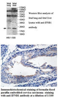 Anti-IFNB1 Antibody – Figure 1 of 1