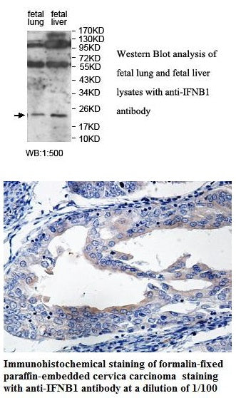 Anti-IFNB1 Antibody – Figure 1 of 1