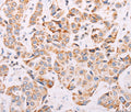 ADAMTS16 Polyclonal Antibody – Figure 1 of 3