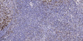 Immunohistochemical analysis of paraffin-embedded human tonsil. 1, Antibody was diluted at 1:200 (4° overnight). 2, STJ92001