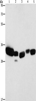 CBR1 Polyclonal Antibody – Figure 1 of 4