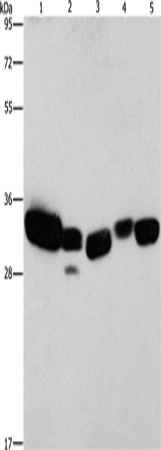 CBR1 Polyclonal Antibody – Figure 1 of 4