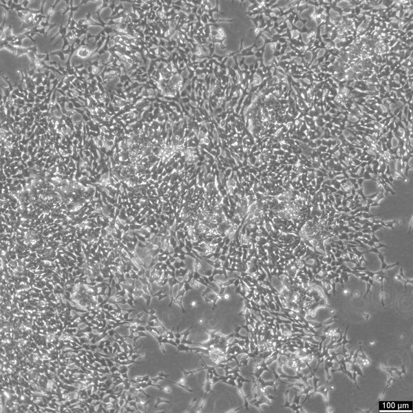 IMR-32 cell