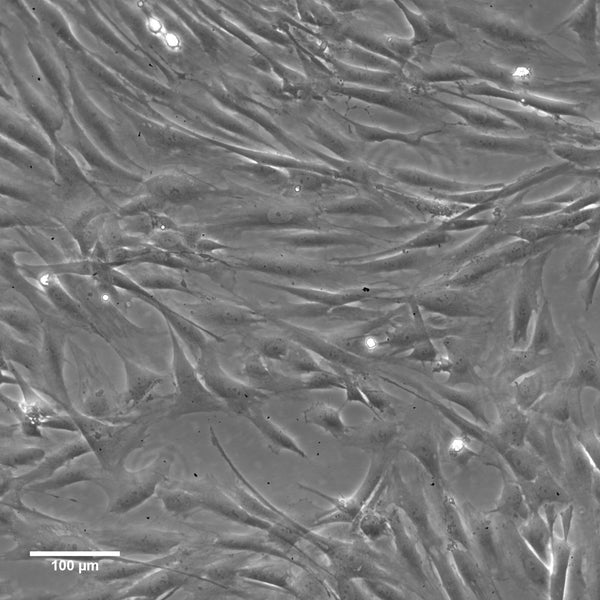imWilms1 cell