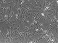 ImWilms10T cell