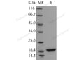 Recombinant Human Alpha-Synuclein/SNCA Protein – Figure 1 of 2