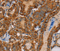 MBNL3 Polyclonal Antibody – Figure 1 of 3