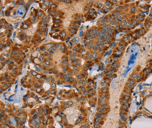 MBNL3 Polyclonal Antibody – Figure 1 of 3