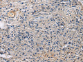SLC30A3 Polyclonal Antibody – Figure 1 of 3
