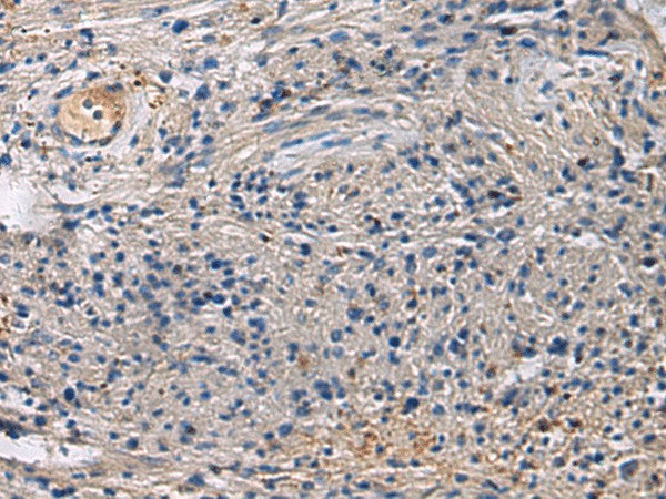 SLC30A3 Polyclonal Antibody – Figure 1 of 3