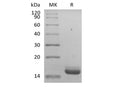 Recombinant Human IL-36 Receptor Antagonist Protein/IL-36RN/IL-1F5 – Figure 1 of 2