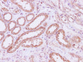 RPLP1 Polyclonal Antibody – Figure 1 of 3