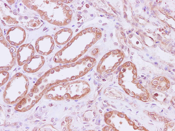 RPLP1 Polyclonal Antibody – Figure 1 of 3