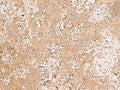 GMPPB Polyclonal Antibody – Figure 1 of 3