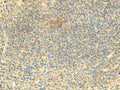 ARL4D Polyclonal Antibody – Figure 1 of 3