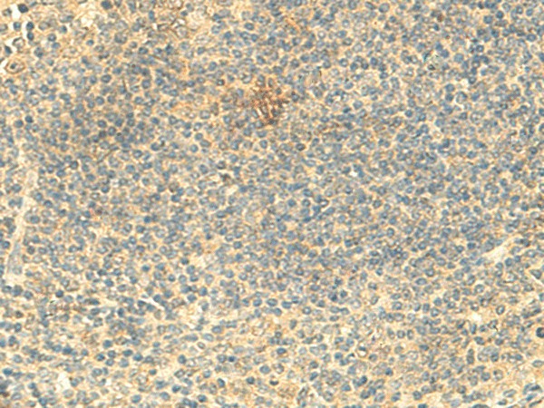 ARL4D Polyclonal Antibody – Figure 1 of 3