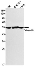 Recombinant Vimentin Monoclonal Antibody – Figure 1 of 4