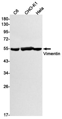 Recombinant Vimentin Monoclonal Antibody – Figure 1 of 4