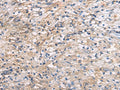 CEP89 Polyclonal Antibody – Figure 1 of 3