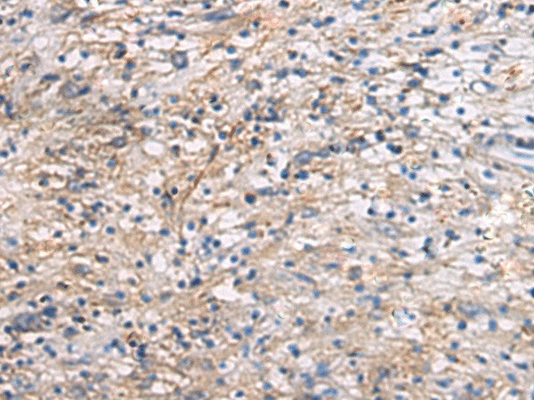 CEP89 Polyclonal Antibody – Figure 1 of 3