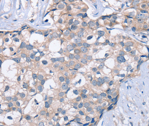 KCNQ5 Polyclonal Antibody – Figure 1 of 3