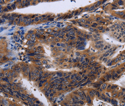 HTR2B Polyclonal Antibody – Figure 1 of 3
