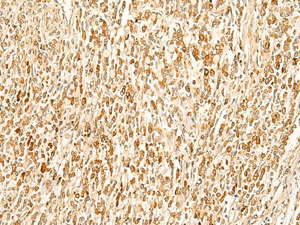 SMUG1 Polyclonal Antibody – Figure 1 of 2