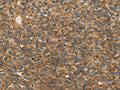 XPR1 Polyclonal Antibody – Figure 1 of 3