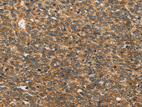 XPR1 Polyclonal Antibody – Figure 1 of 3