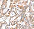 ACSBG1 Polyclonal Antibody – Figure 1 of 3