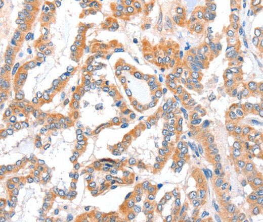 ACSBG1 Polyclonal Antibody – Figure 1 of 3