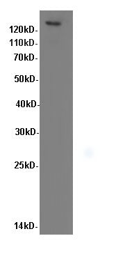 ITGB1 Polyclonal Antibody – Figure 1 of 2