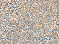 CMTM4 Polyclonal Antibody – Figure 1 of 3
