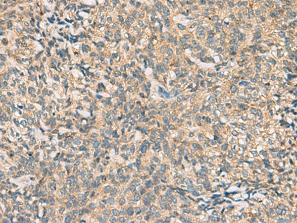 CMTM4 Polyclonal Antibody – Figure 1 of 3